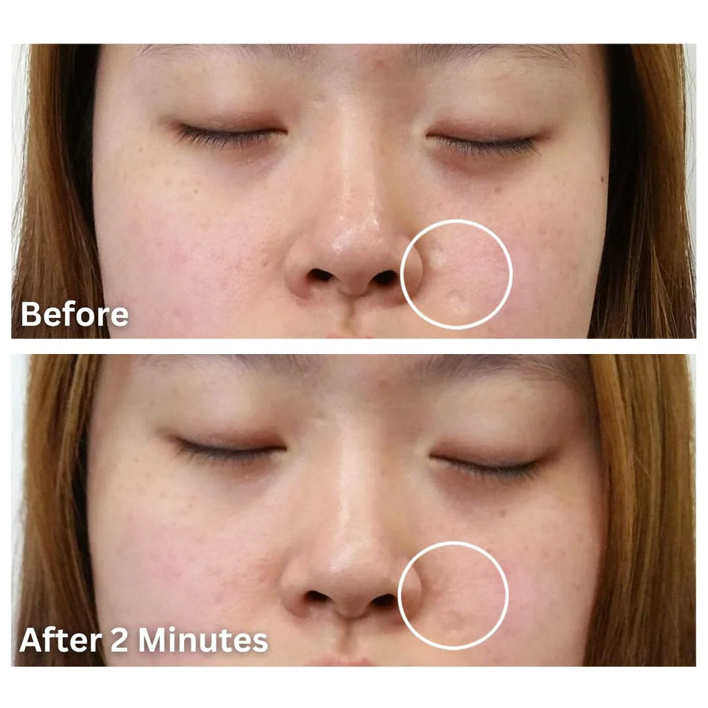 Waterproof Scar Filler & Full Coverage Concealer Refill Applicator for Face and Body H400