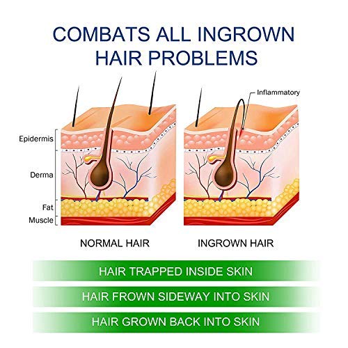 Shaving Gel for Ingrown Hair and Razor Bumps, 2-Pack M60882