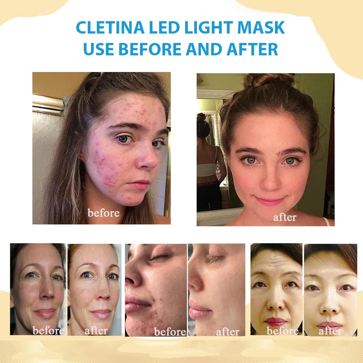 LED Face Mask, Rechargeable, Portable for Home and Travel U245141